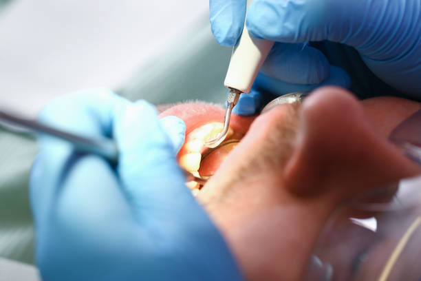 Best Emergency Dental Services for Seniors in Los Osos, CA