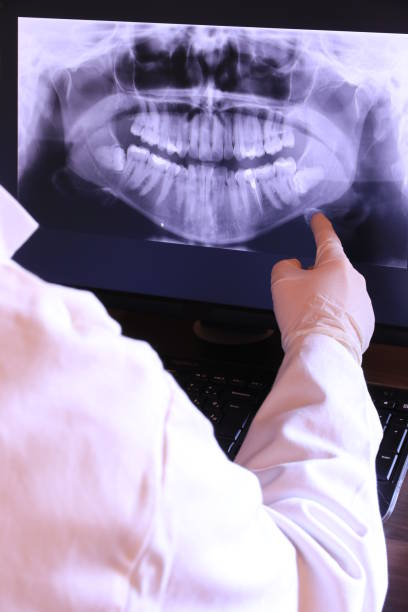 Best Weekend Emergency Dentist in Los Osos, CA