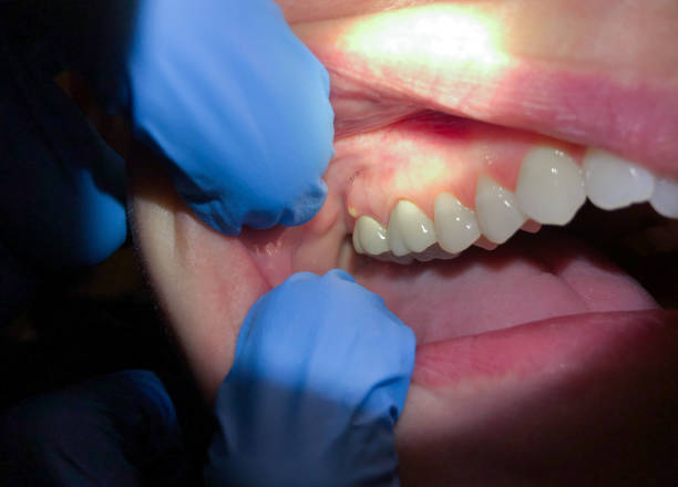 Best Mobile Emergency Dentist in Los Osos, CA