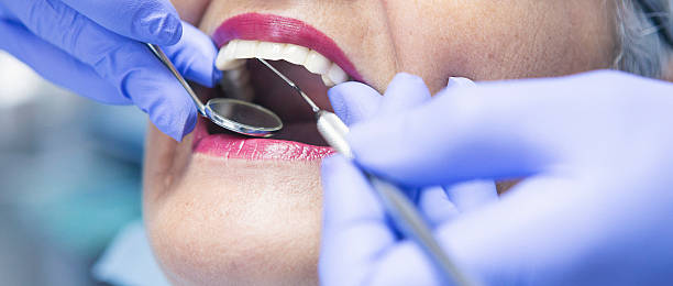 Best Emergency Cosmetic Dentistry in Los Osos, CA